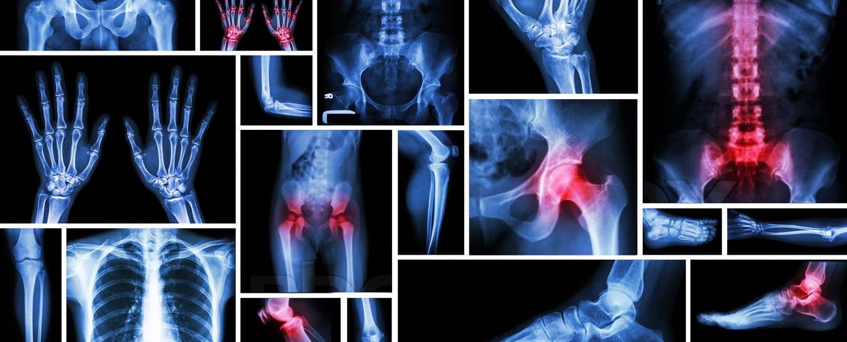 Cirugía Articular