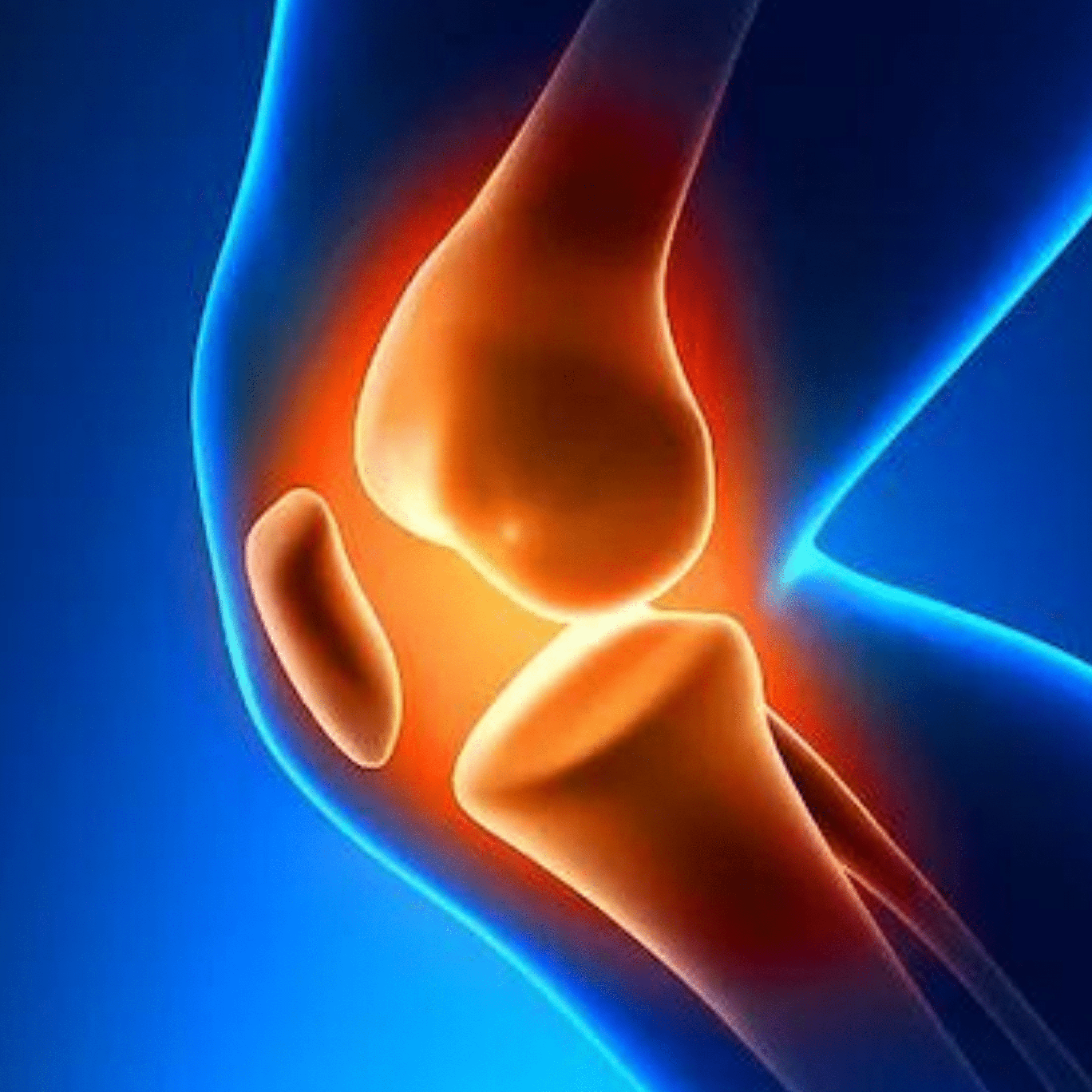 Rodilla